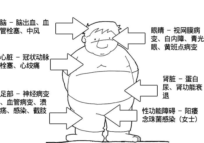 人人都要了解的糖尿病知识